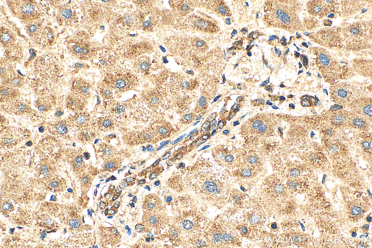 IHC staining of human liver using 10847-1-AP