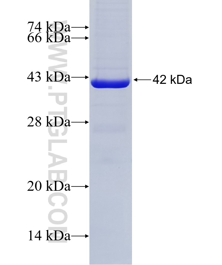 RPA1 fusion protein Ag28239 SDS-PAGE