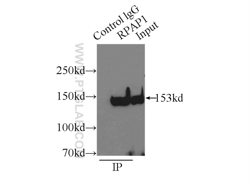 IP experiment of HeLa using 15138-1-AP