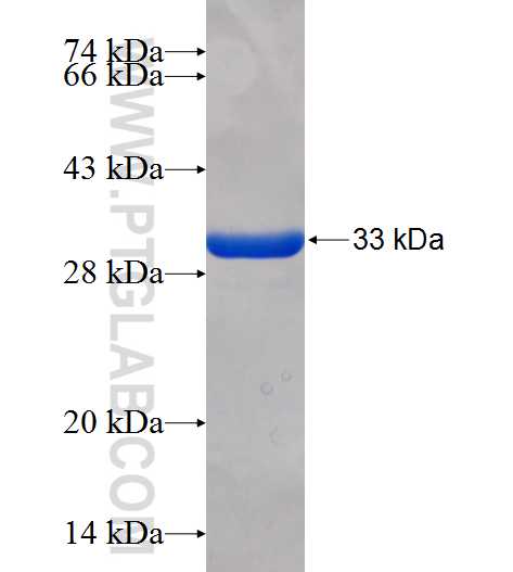 RPGRIP1 fusion protein Ag25695 SDS-PAGE