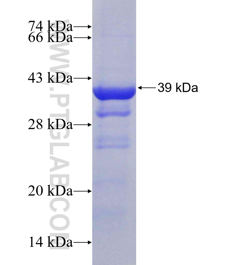 RPGRIP1 fusion protein Ag31294 SDS-PAGE