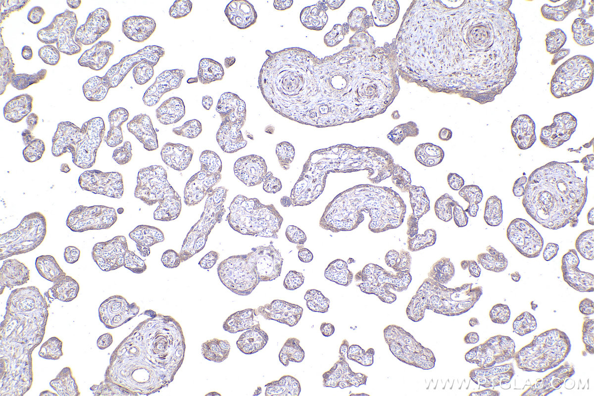 IHC staining of human placenta using 14536-1-AP