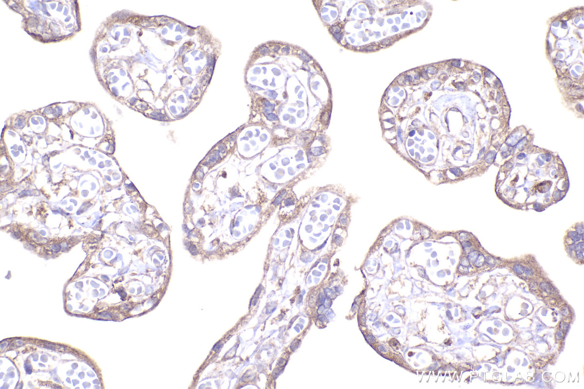 IHC staining of human placenta using 14536-1-AP