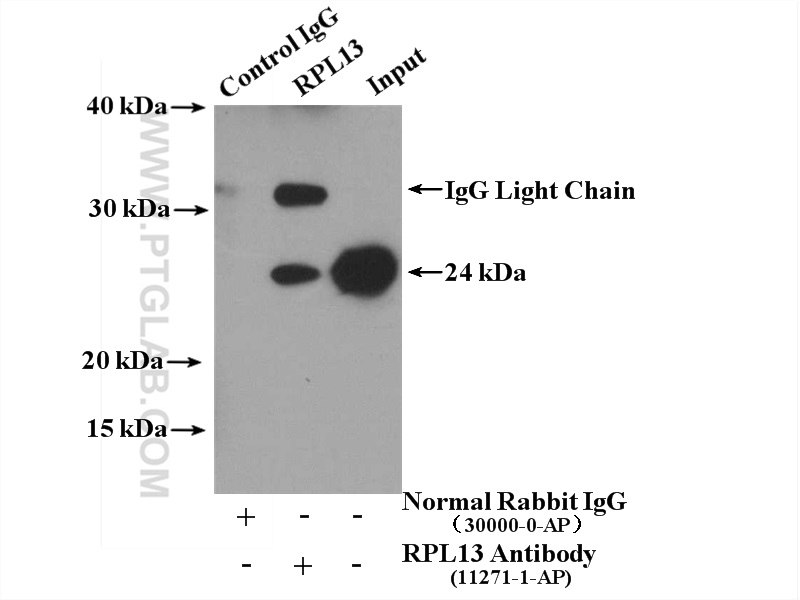 IP experiment of HeLa using 11271-1-AP