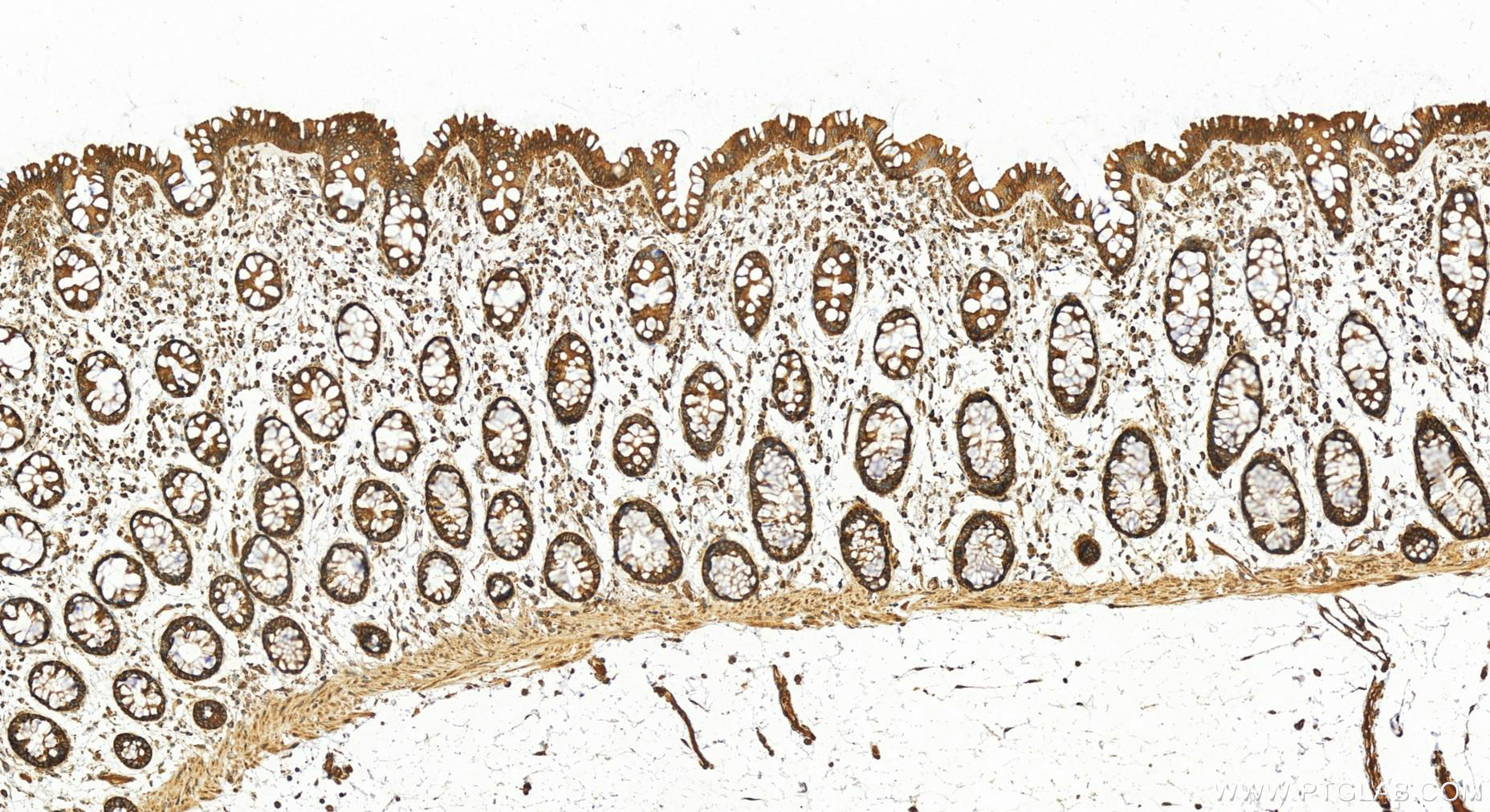 IHC staining of human colon using 16740-1-AP