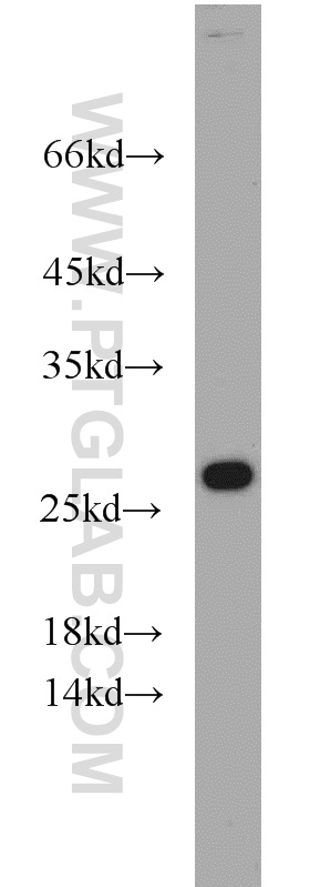 WB analysis of COLO 320 using 16740-1-AP