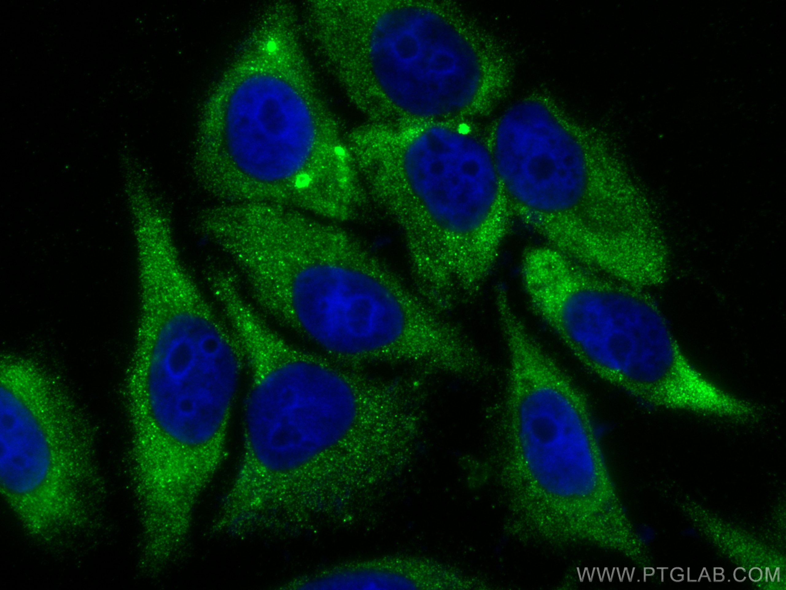 IF Staining of HepG2 using 14653-1-AP