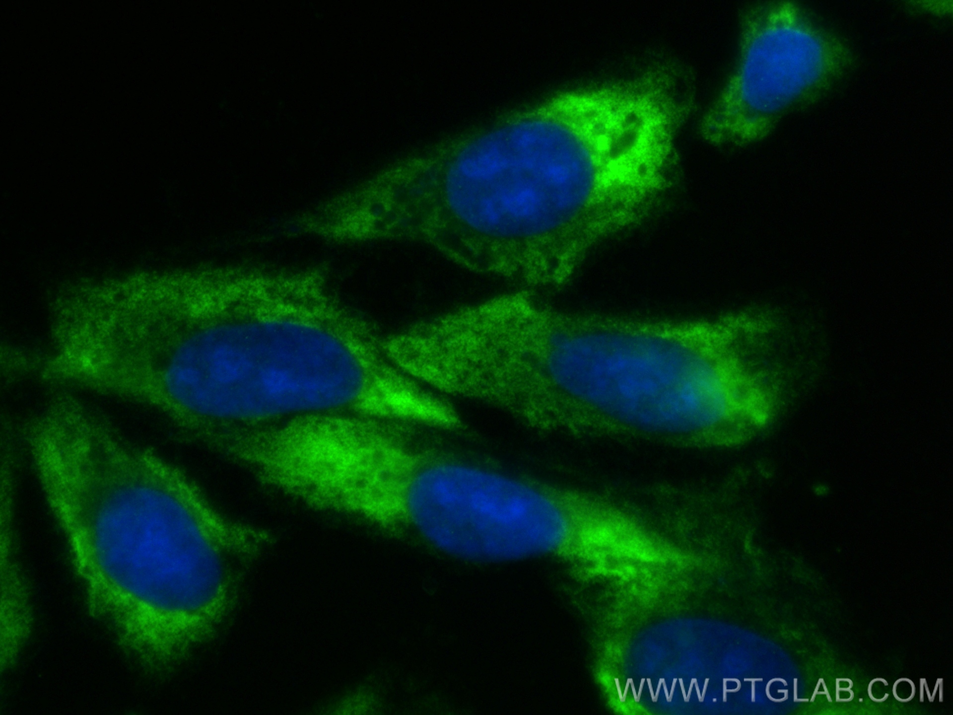 IF Staining of U2OS using 15226-1-AP