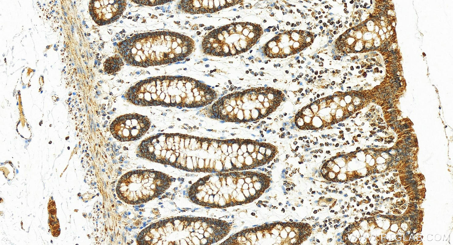 IHC staining of human normal colon using 16386-1-AP