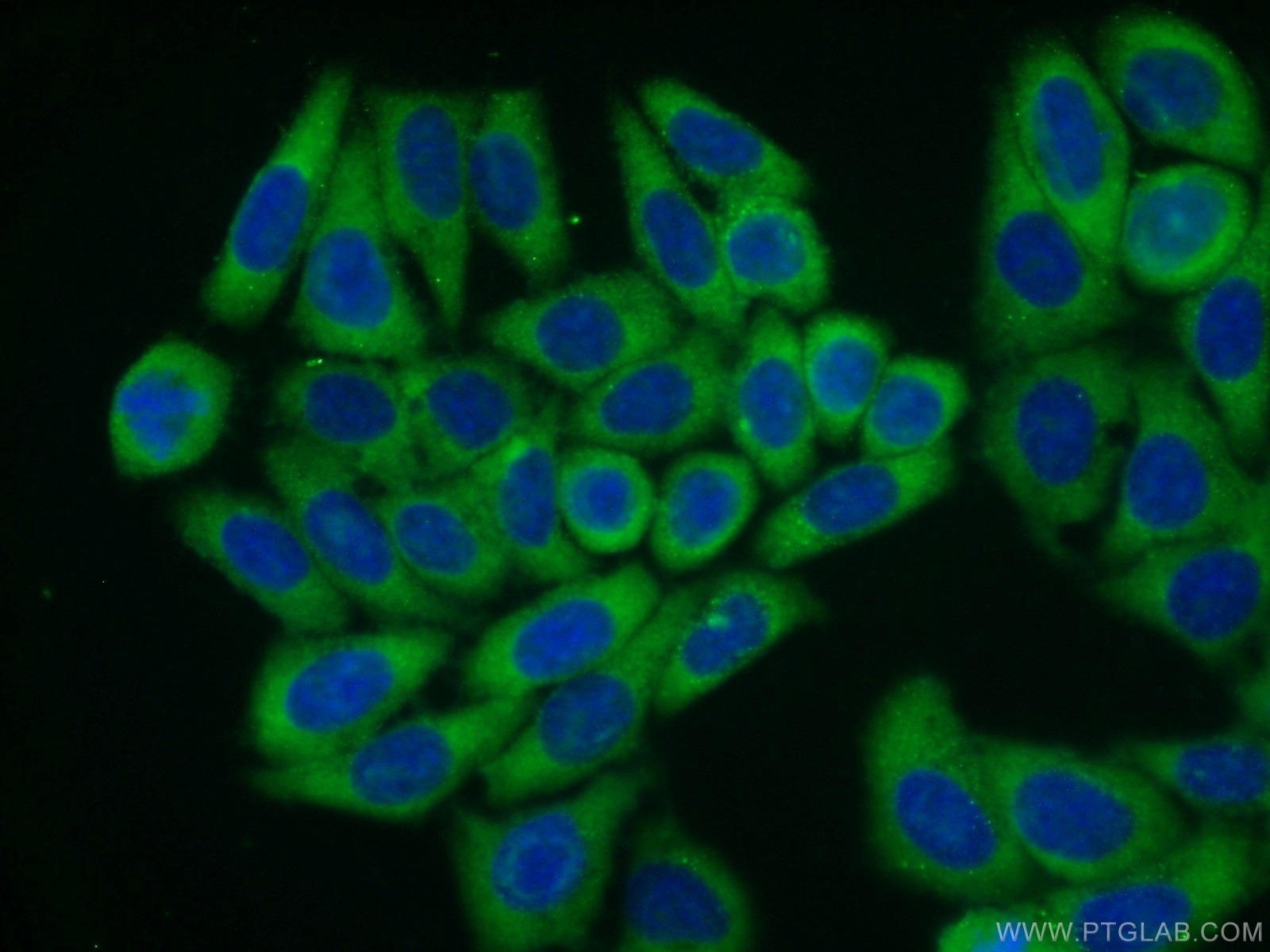 IF Staining of HepG2 using 16386-1-AP