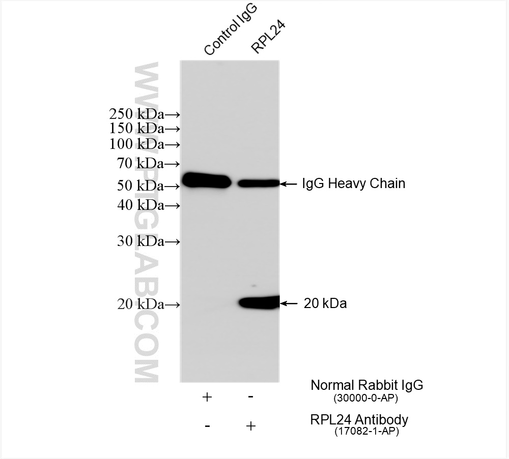 IP experiment of HEK-293 using 17082-1-AP