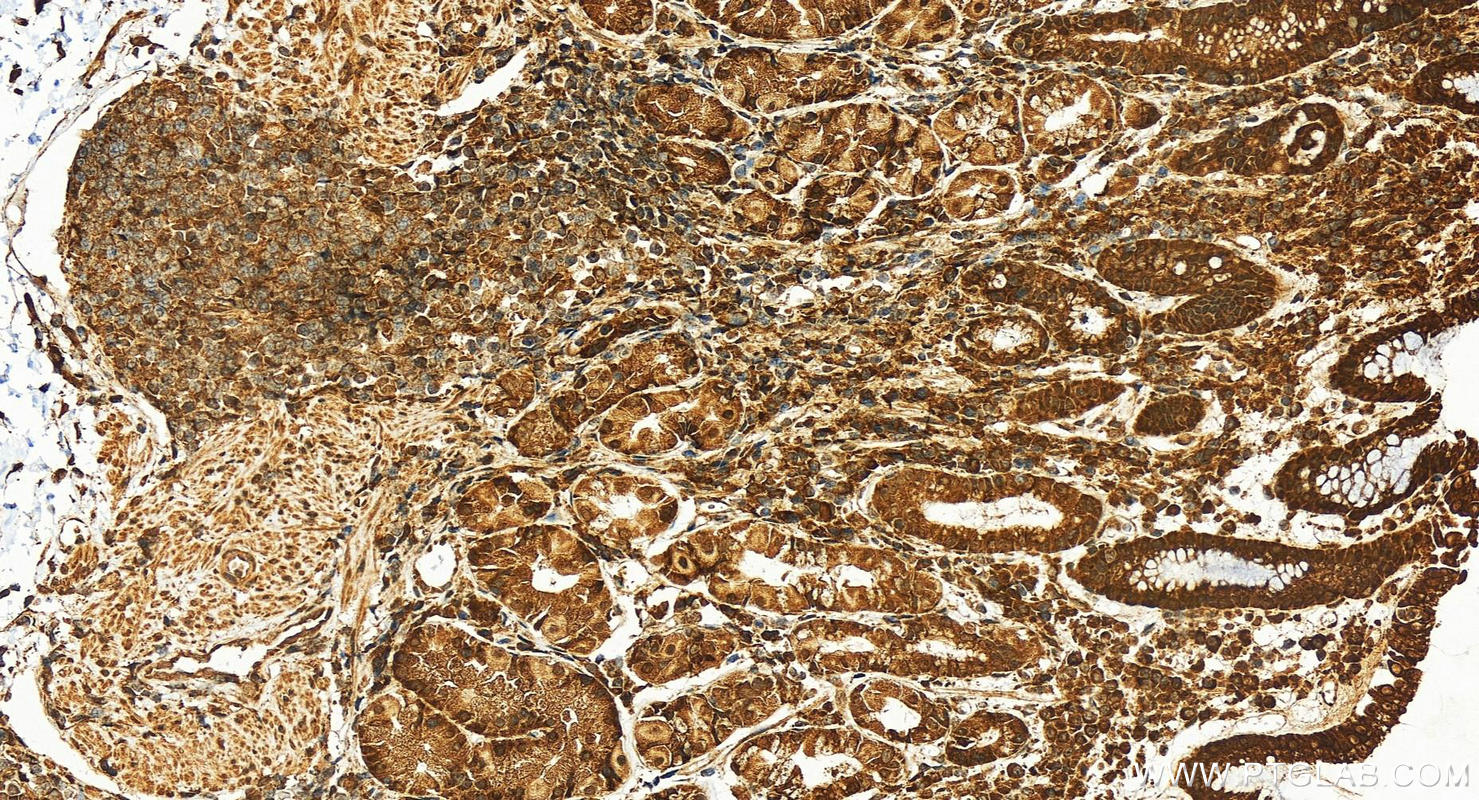 IHC staining of human stomach using 16487-1-AP