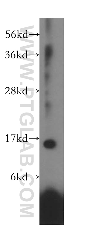 WB analysis of HeLa using 16649-1-AP (same clone as 16649-1-PBS)