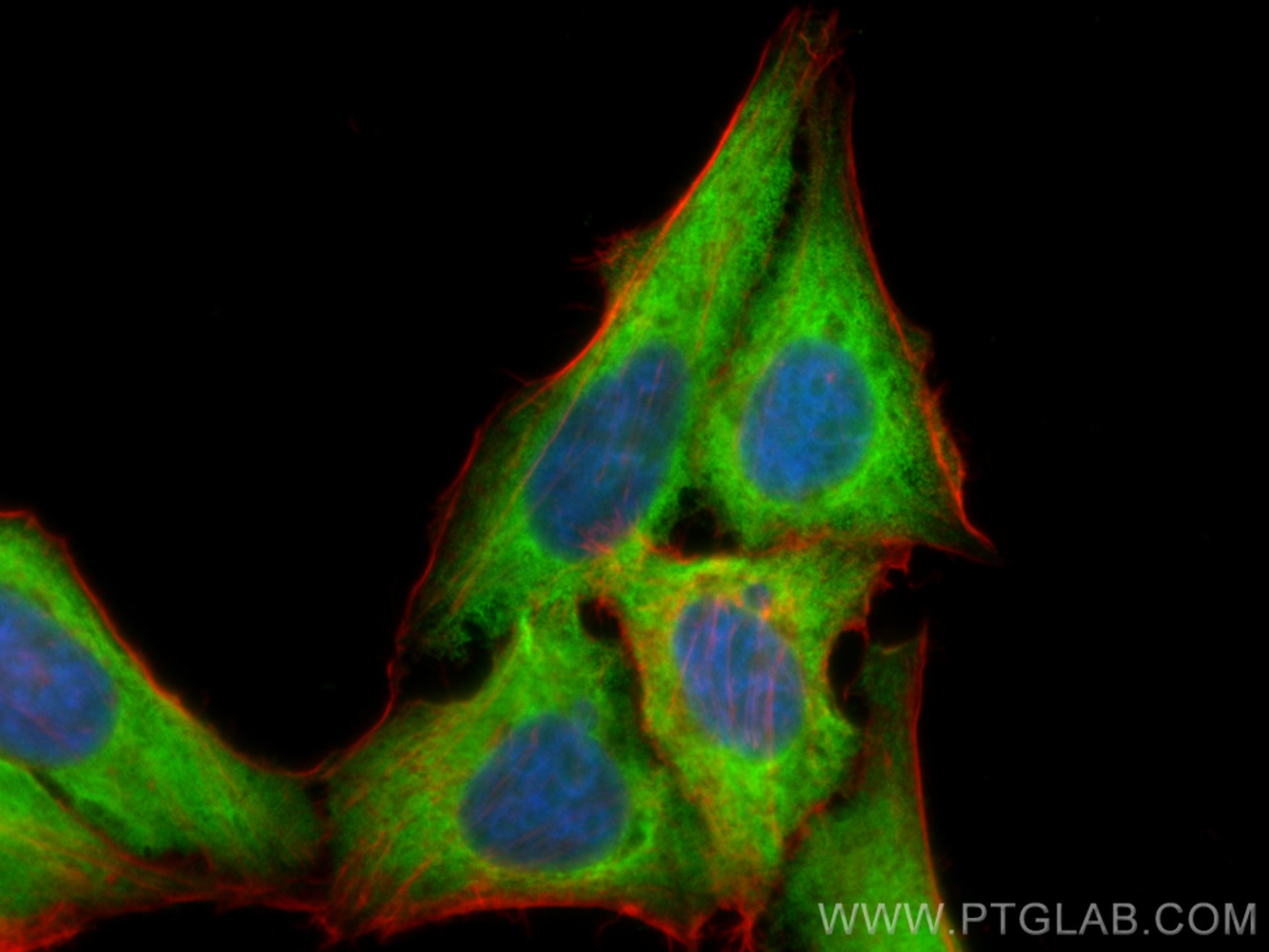 IF Staining of HepG2 using 15799-1-AP