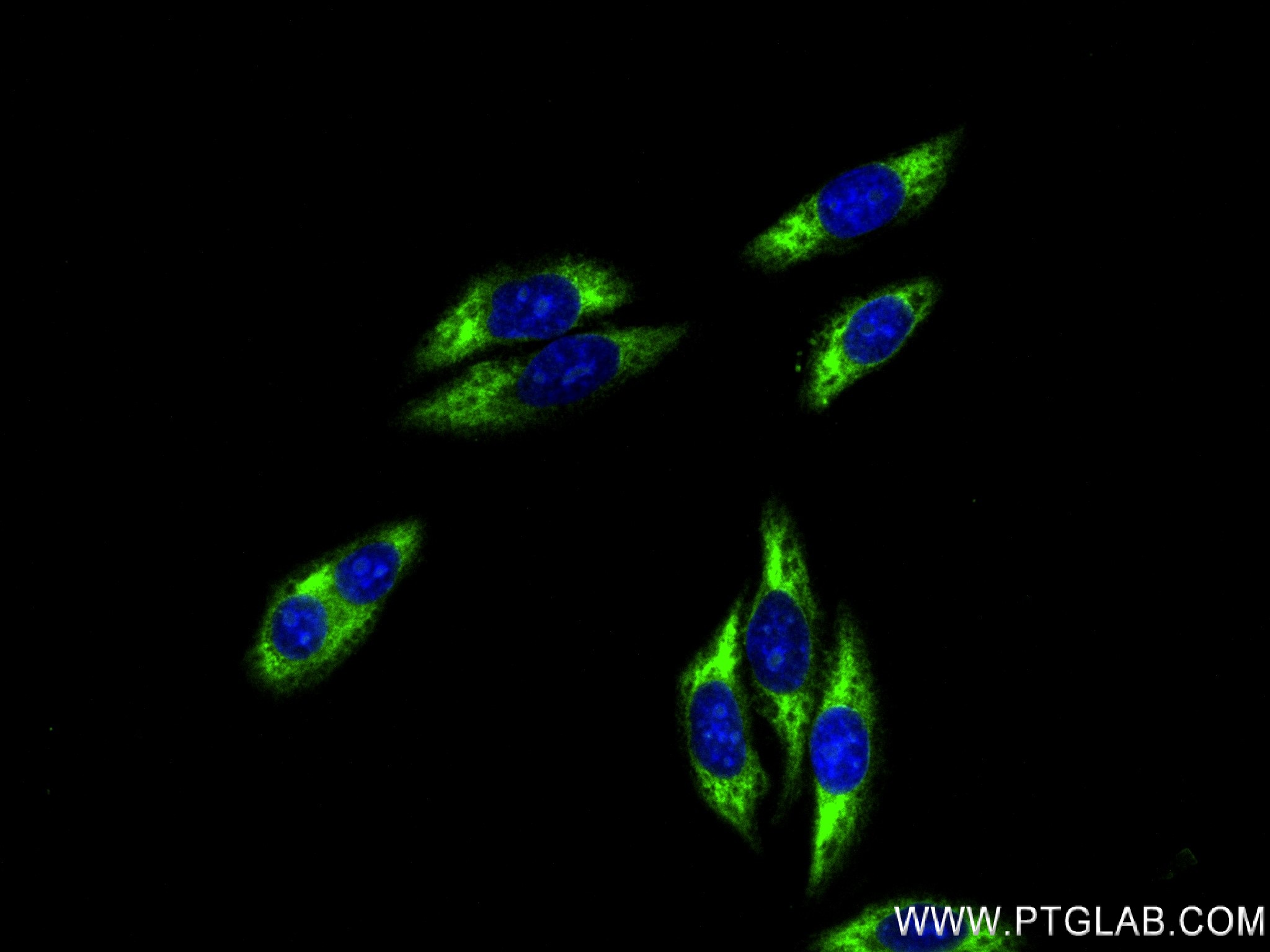 IF Staining of HepG2 using 83377-1-RR