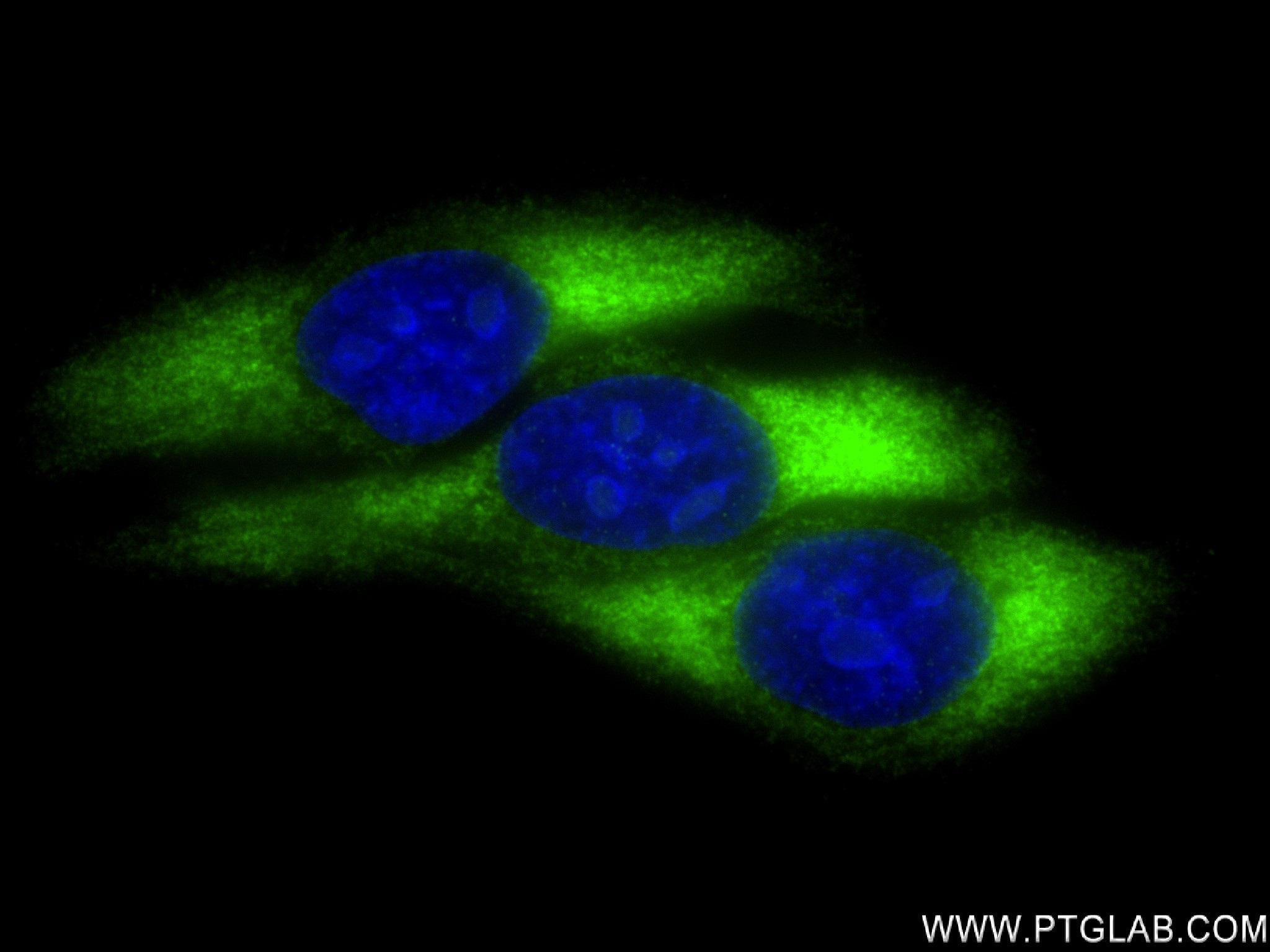 IF Staining of HepG2 using 83377-1-RR