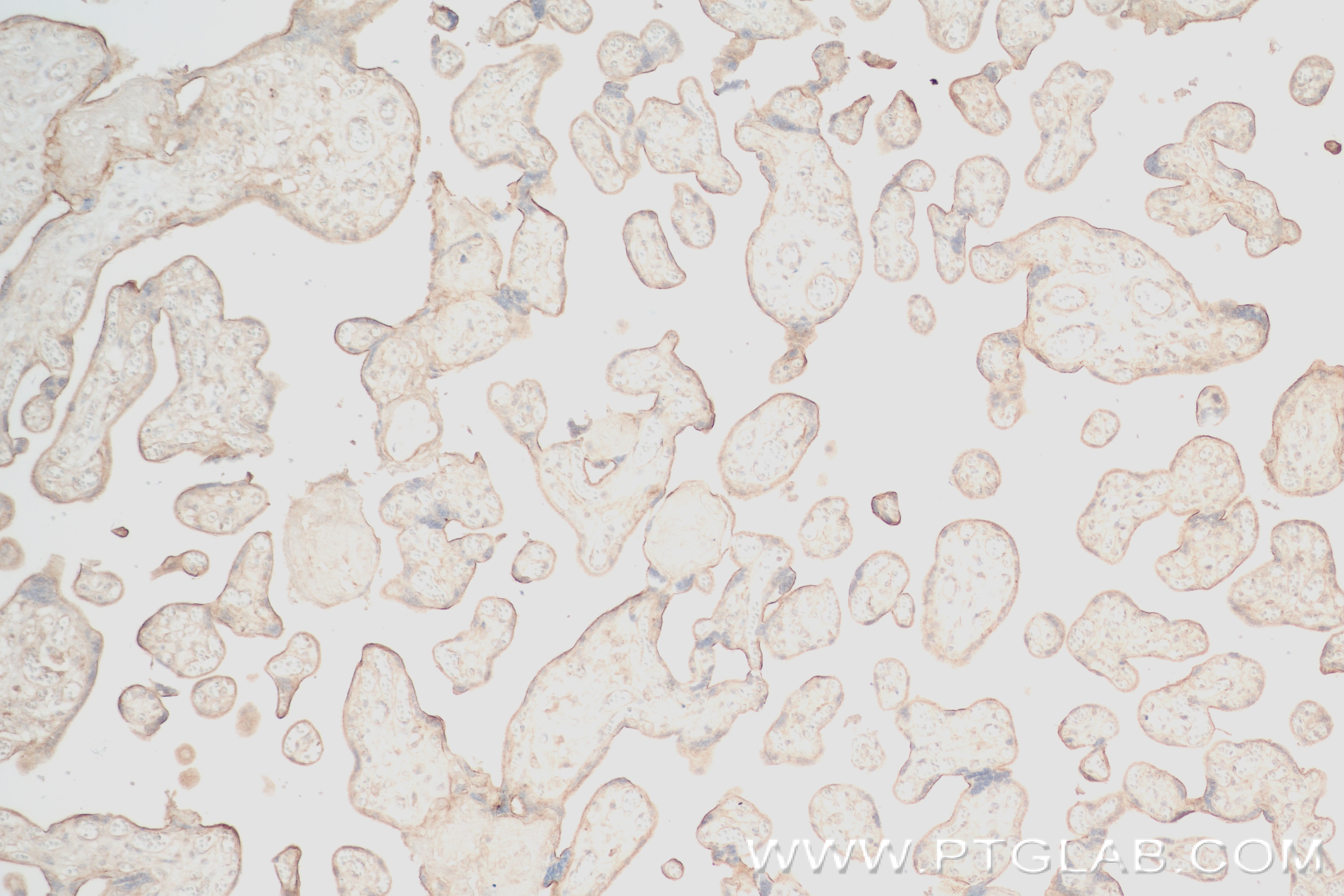 IHC staining of human placenta using 82815-1-RR (same clone as 82815-1-PBS)