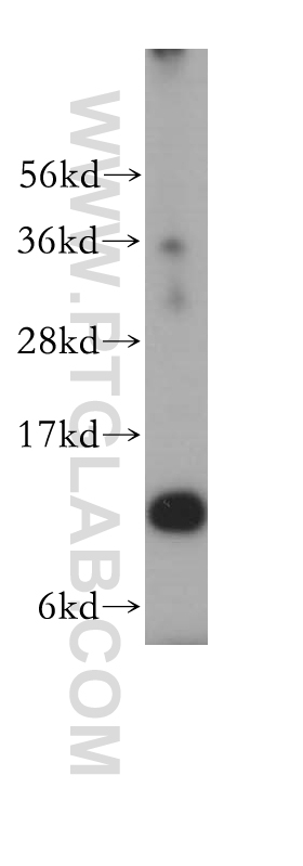 WB analysis of A549 using 17403-1-AP