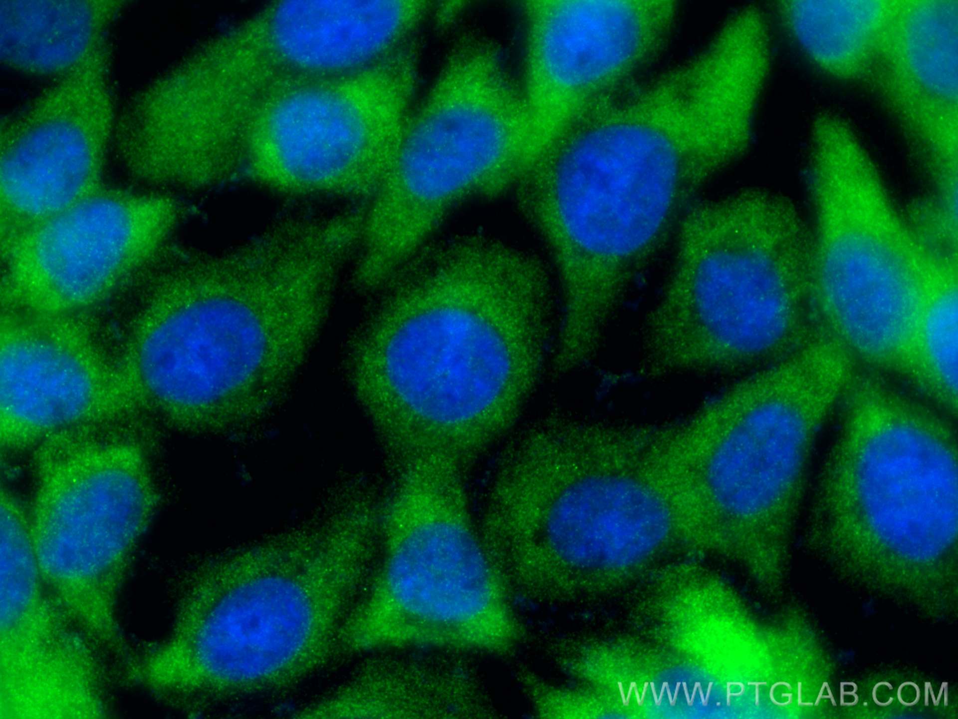 IF Staining of A431 using 15179-1-AP