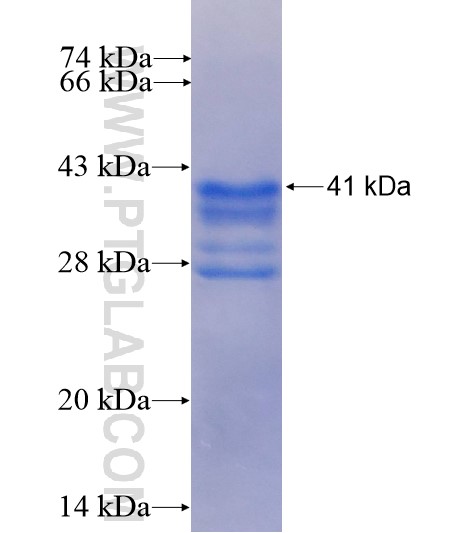 RPL35 fusion protein Ag6615 SDS-PAGE