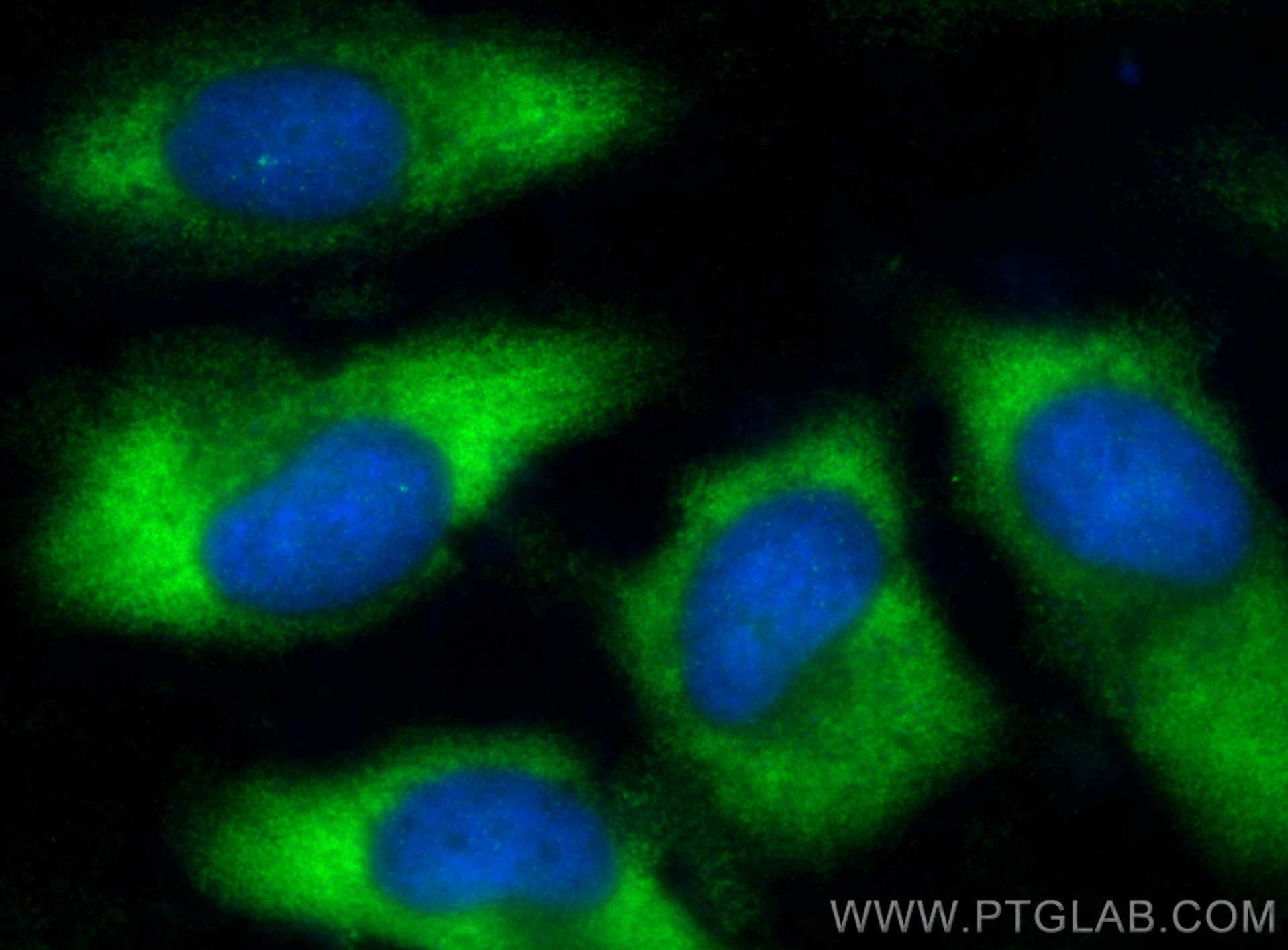 IF Staining of HeLa using 15145-1-AP