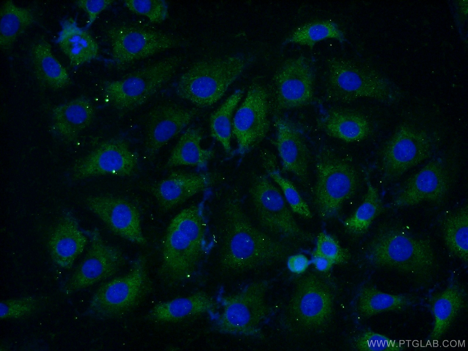 IF Staining of SH-SY5Y using 14660-1-AP