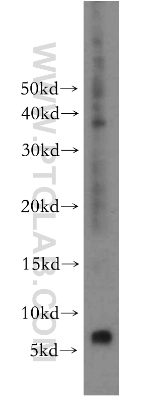 WB analysis of HeLa using 15055-1-AP