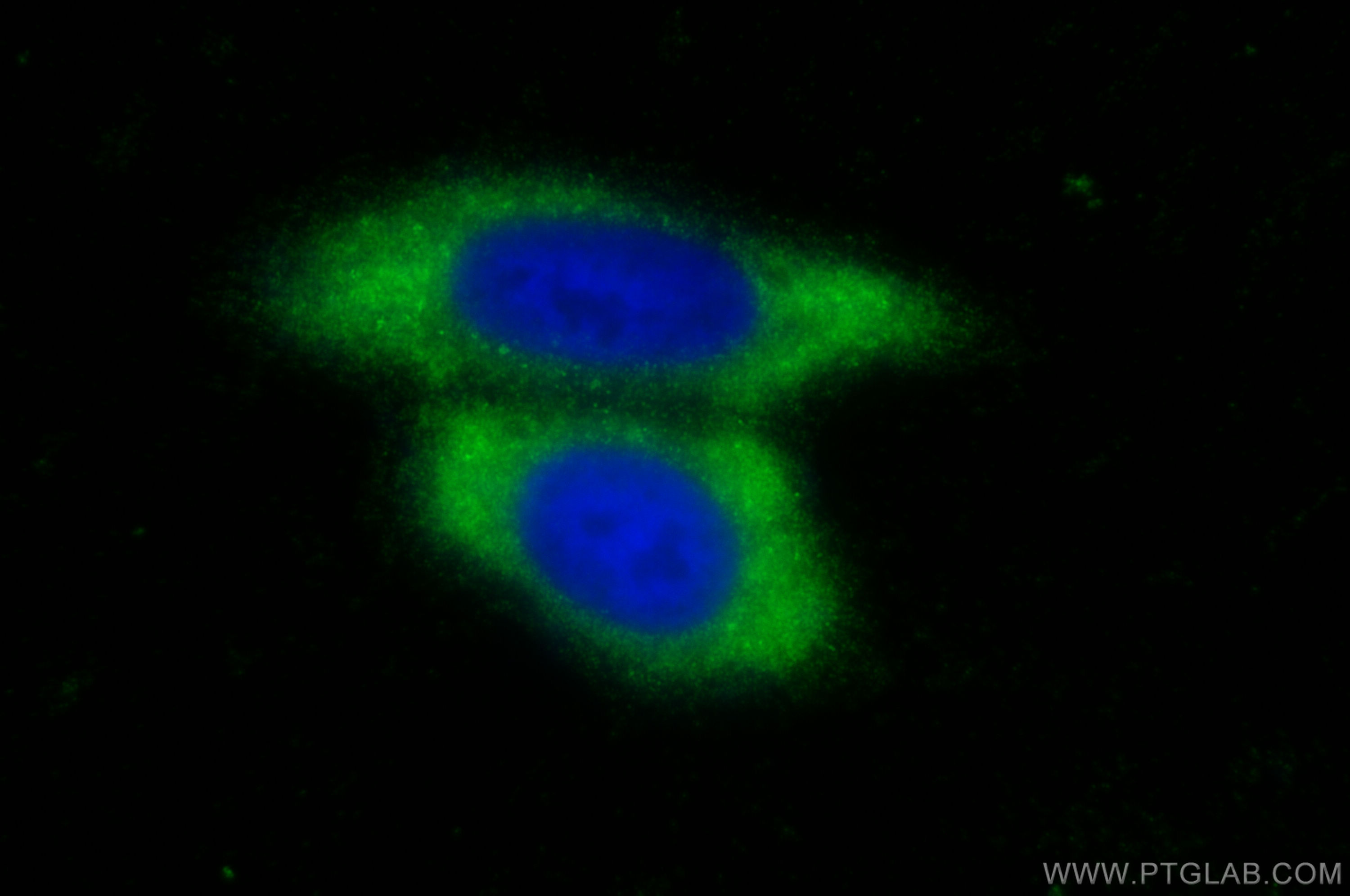 IF Staining of HepG2 using 14990-1-AP