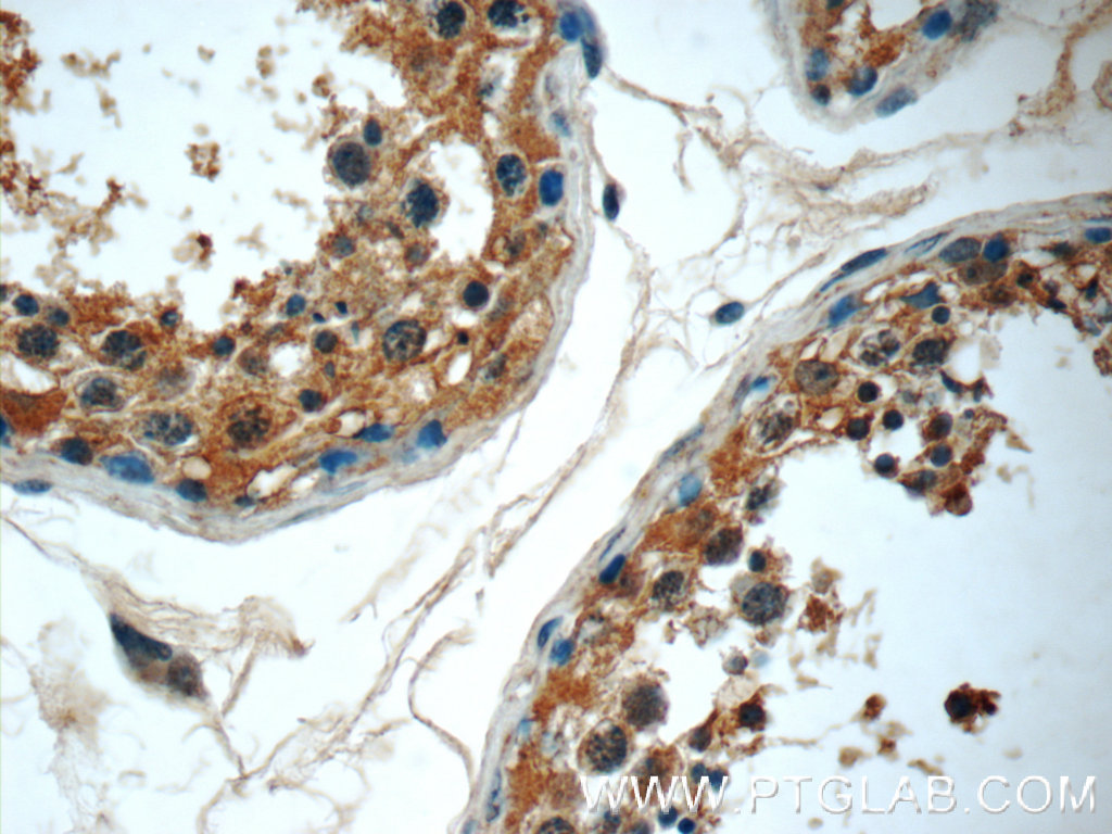 IHC staining of human testis using 24940-1-AP