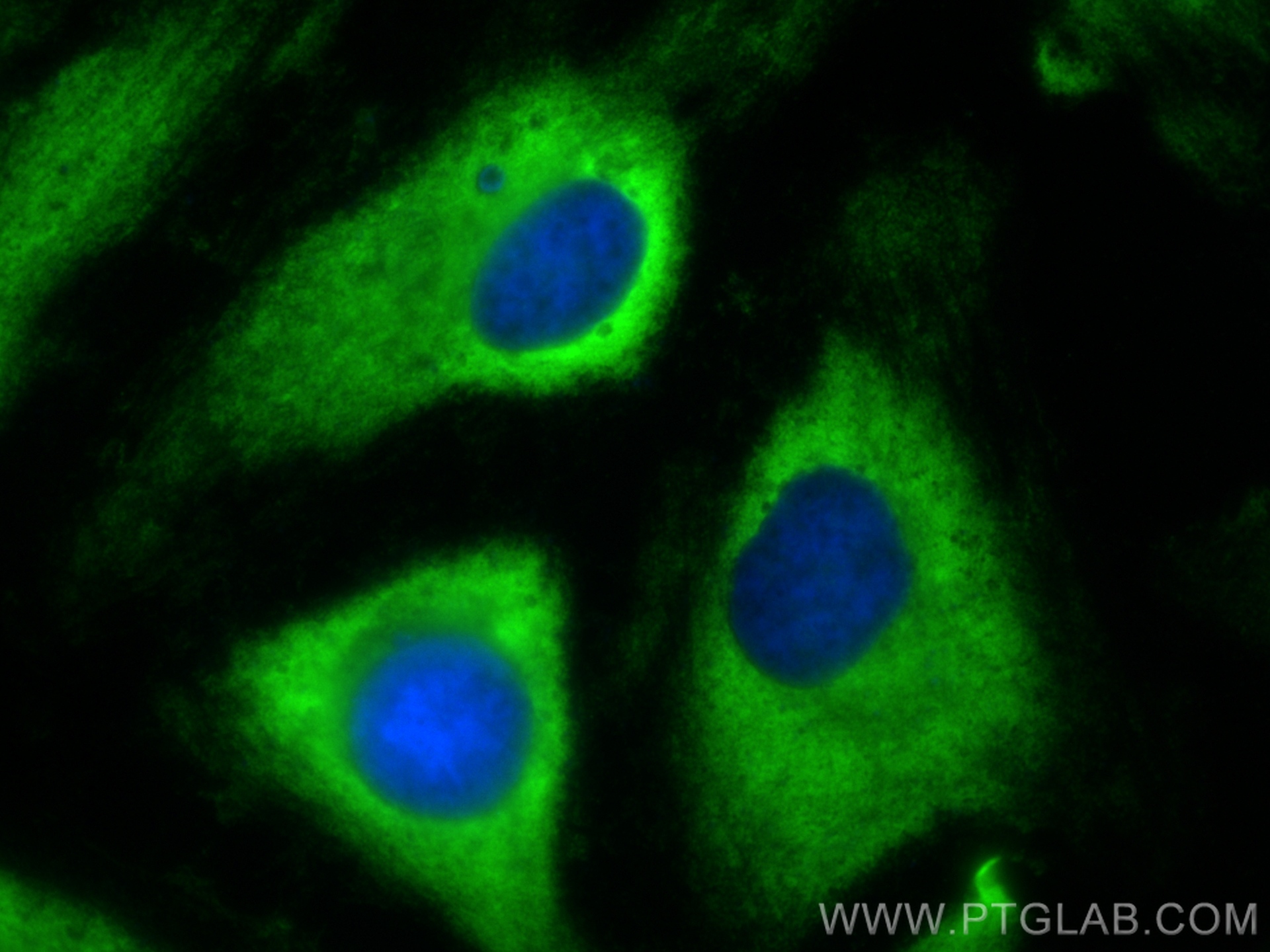 IF Staining of HeLa using 11302-1-AP