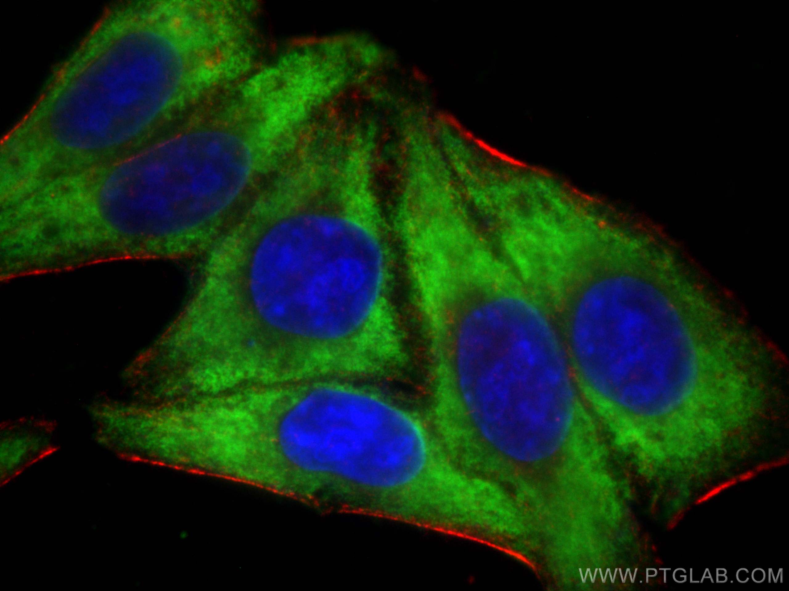 IF Staining of HepG2 using 67028-1-Ig (same clone as 67028-1-PBS)