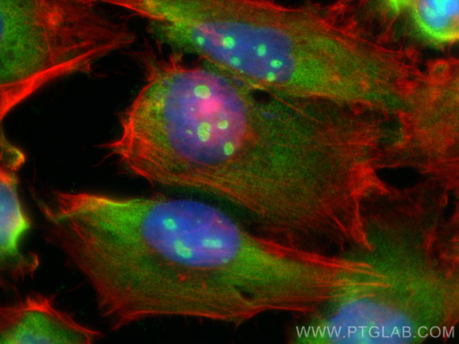 IF Staining of U-251 using 29092-1-AP