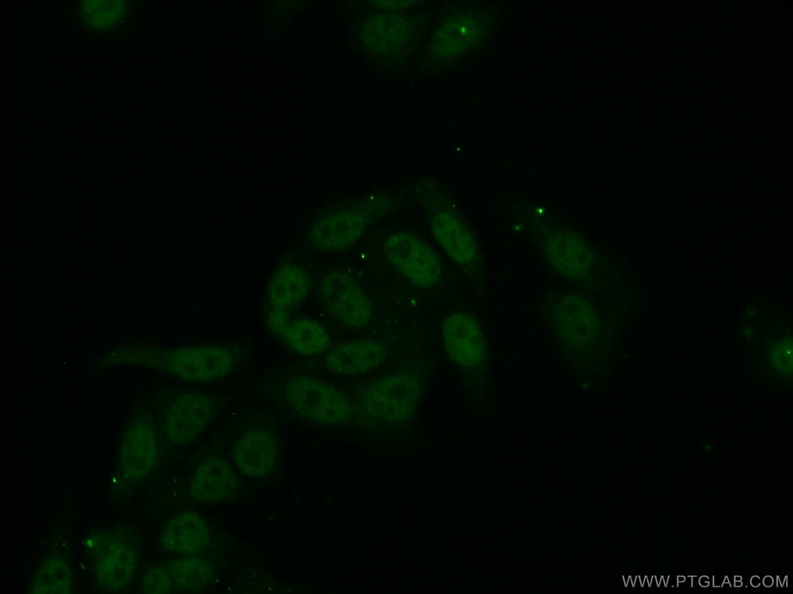 IF Staining of HepG2 using 15387-1-AP