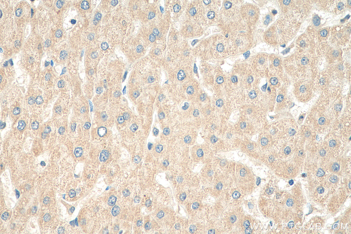 IHC staining of human liver using 15387-1-AP