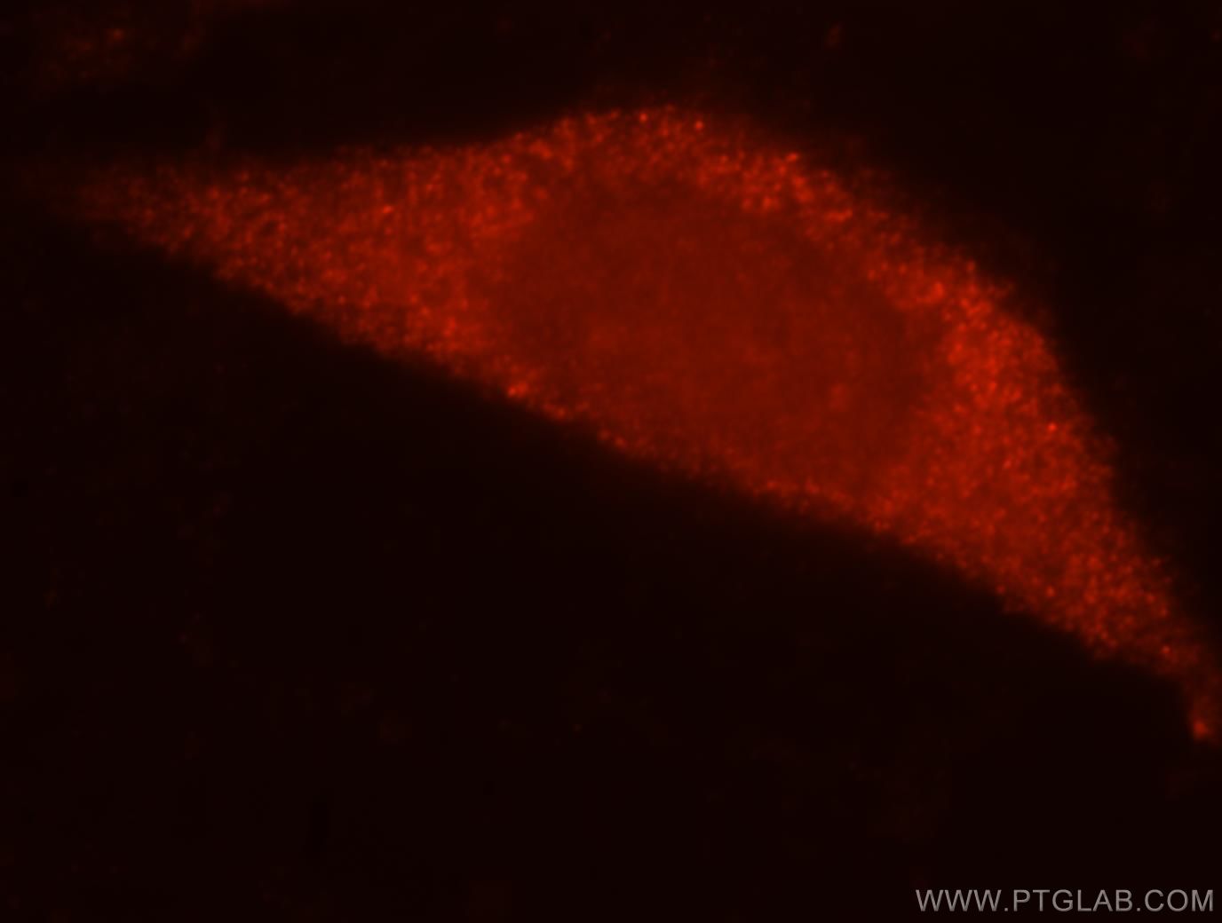 IF Staining of MCF-7 using 16707-1-AP