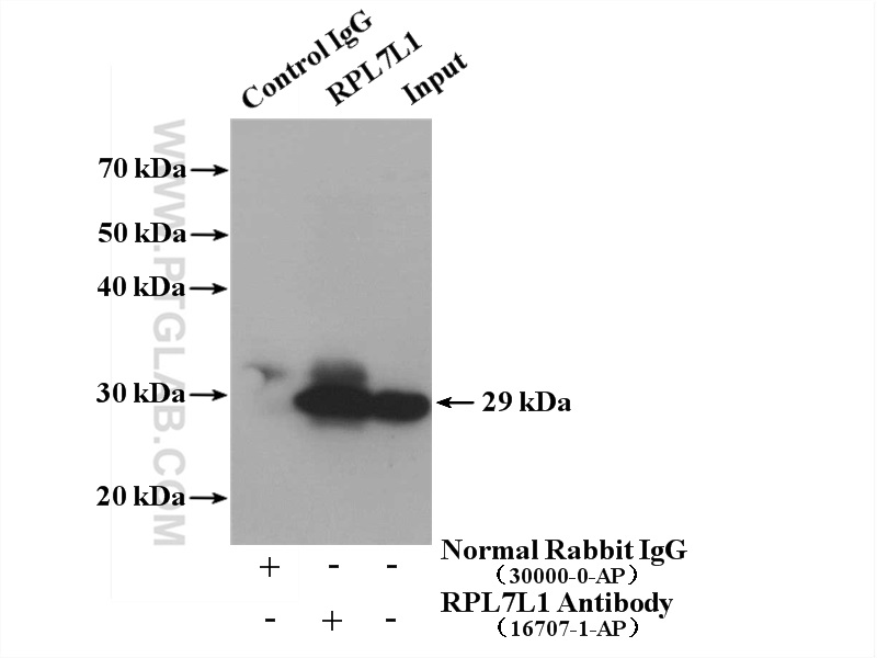 IP experiment of HepG2 using 16707-1-AP