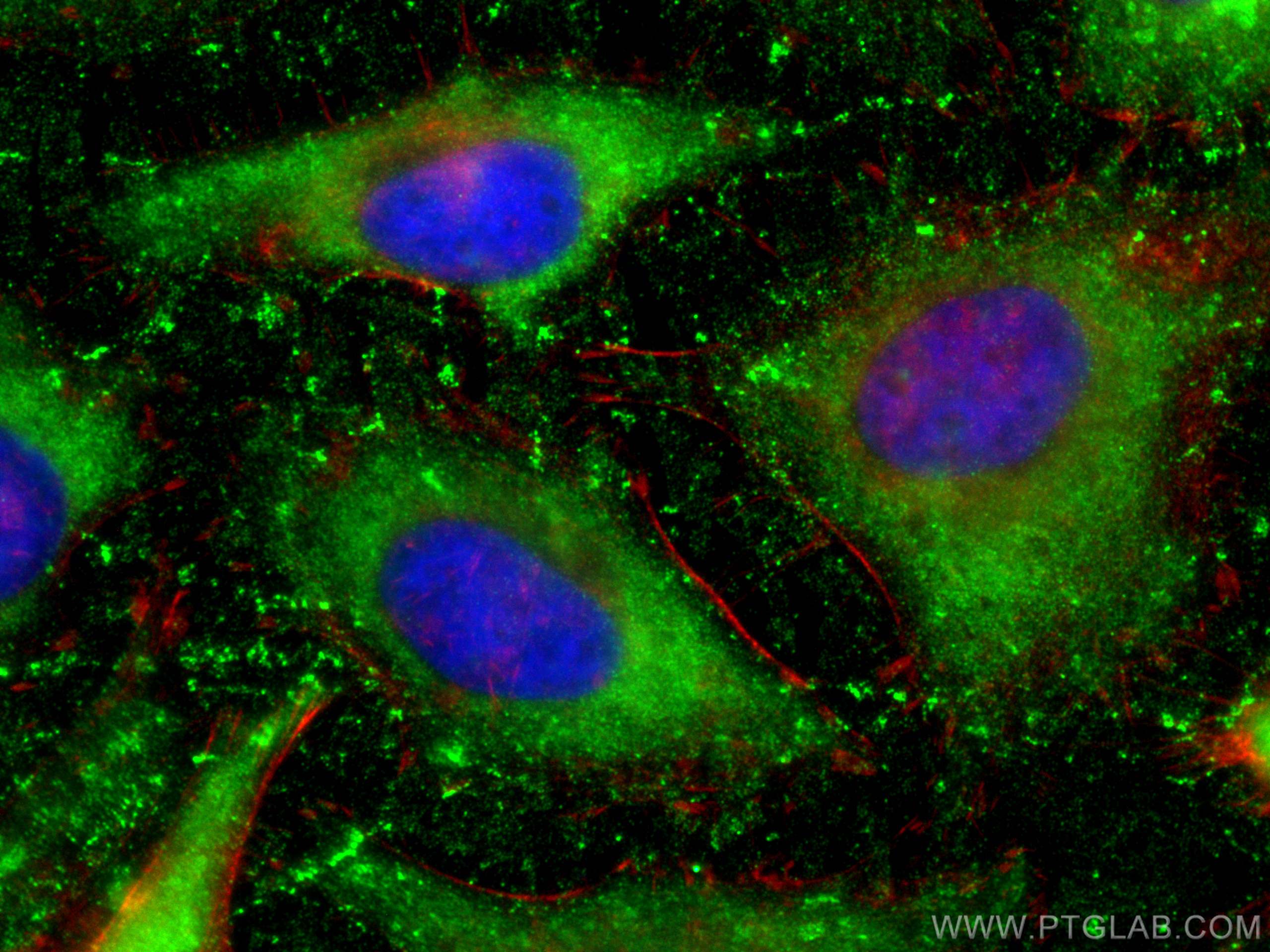 IF Staining of HeLa using 21636-1-AP