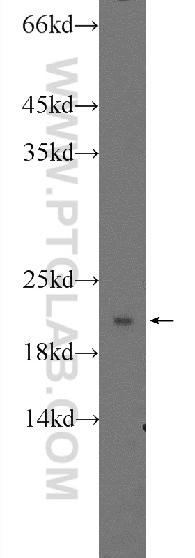 WB analysis of HeLa using 21636-1-AP