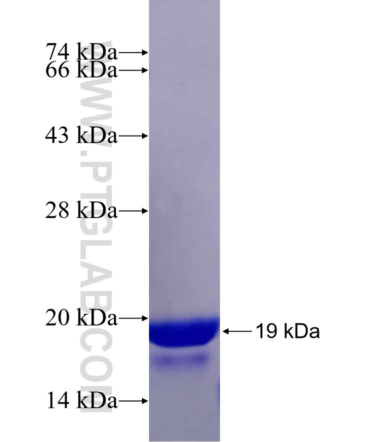 RPLP2 fusion protein Ag29451 SDS-PAGE