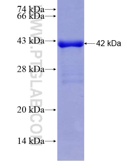 RPN1 fusion protein Ag28586 SDS-PAGE