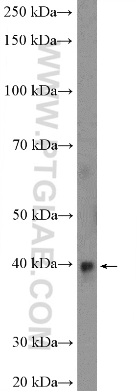 WB analysis of rat kidney using 12874-1-AP