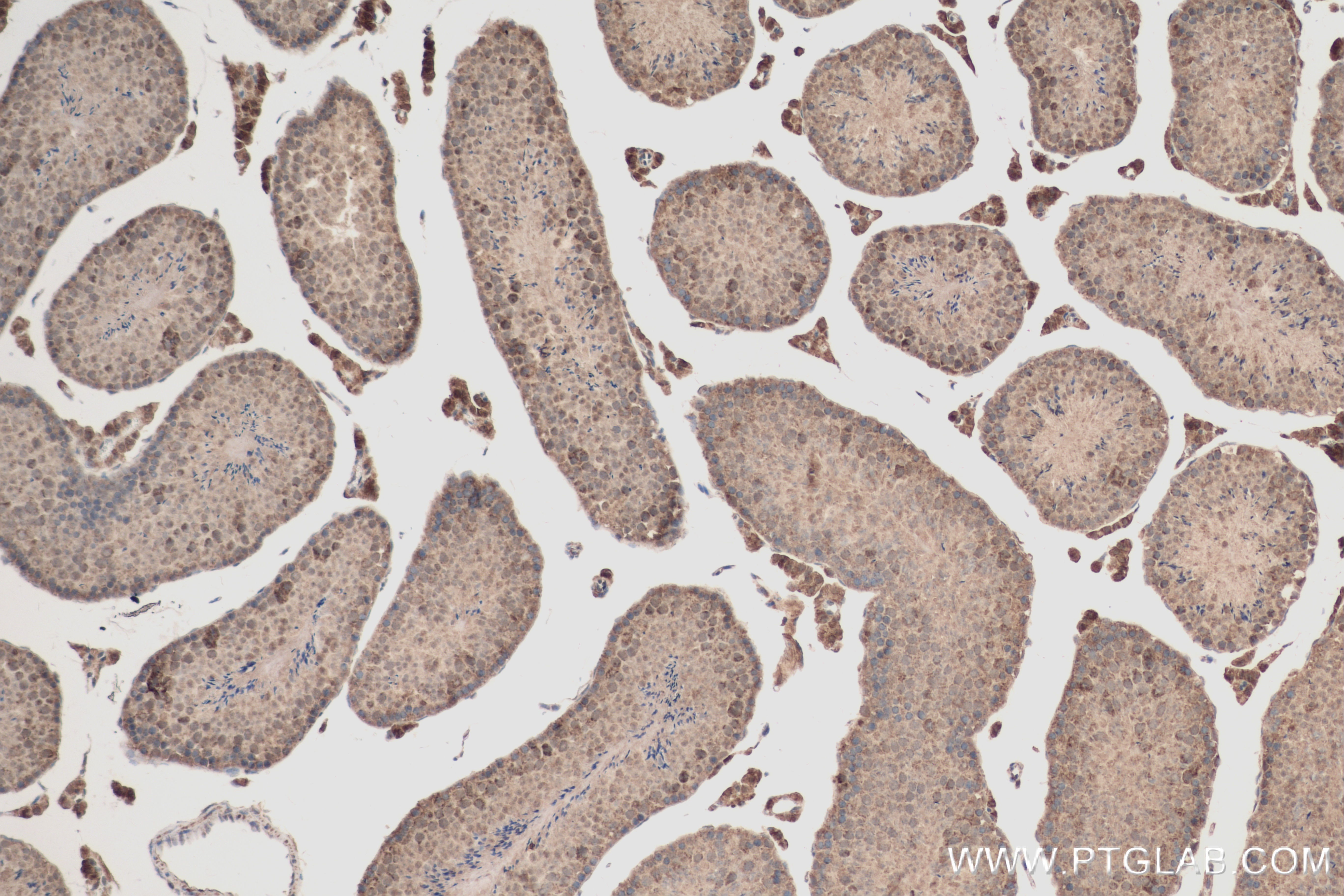 IHC staining of mouse testis using 83517-3-RR (same clone as 83517-3-PBS)