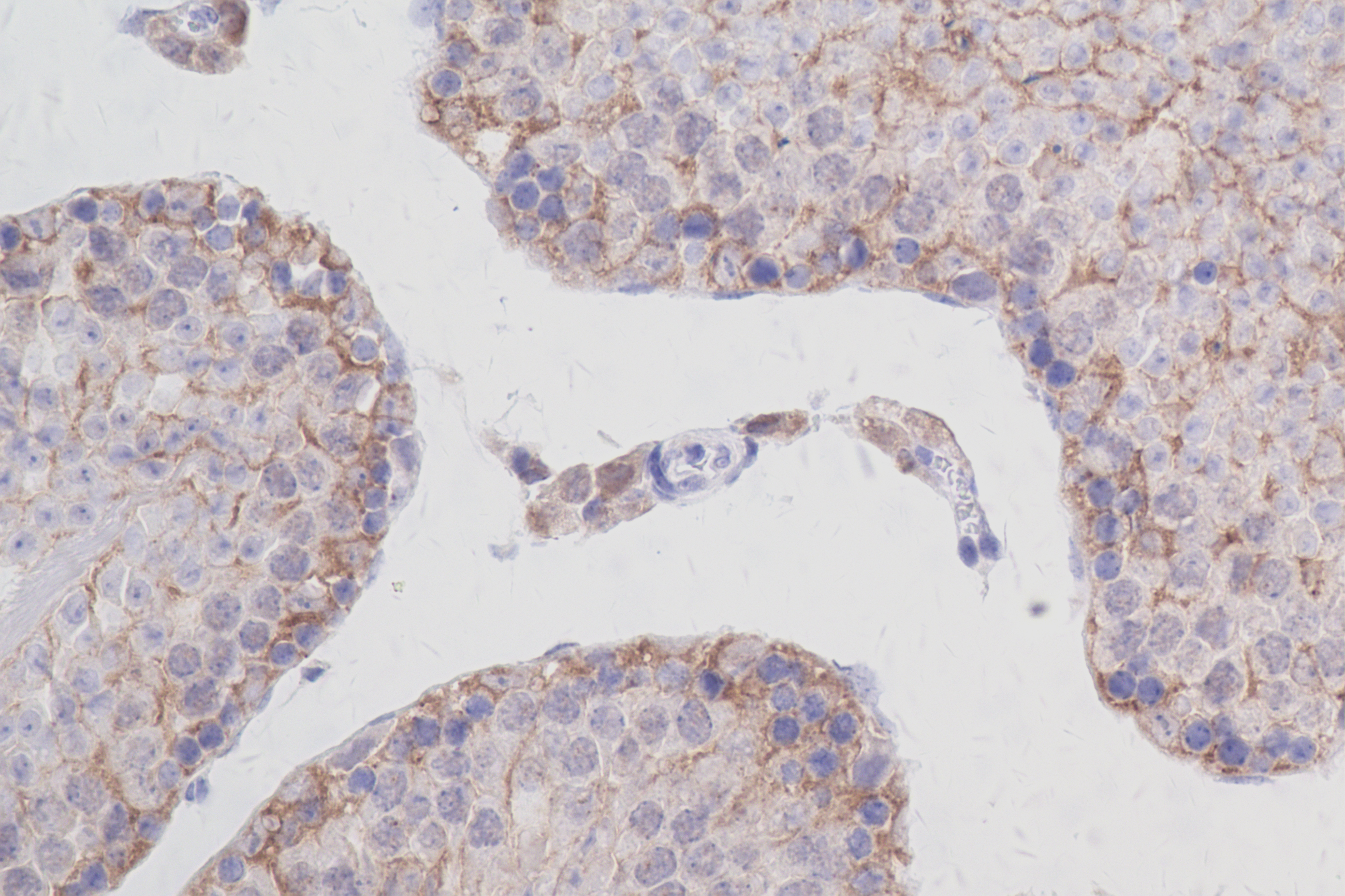 IHC staining of mouse testis using 83517-3-RR (same clone as 83517-3-PBS)