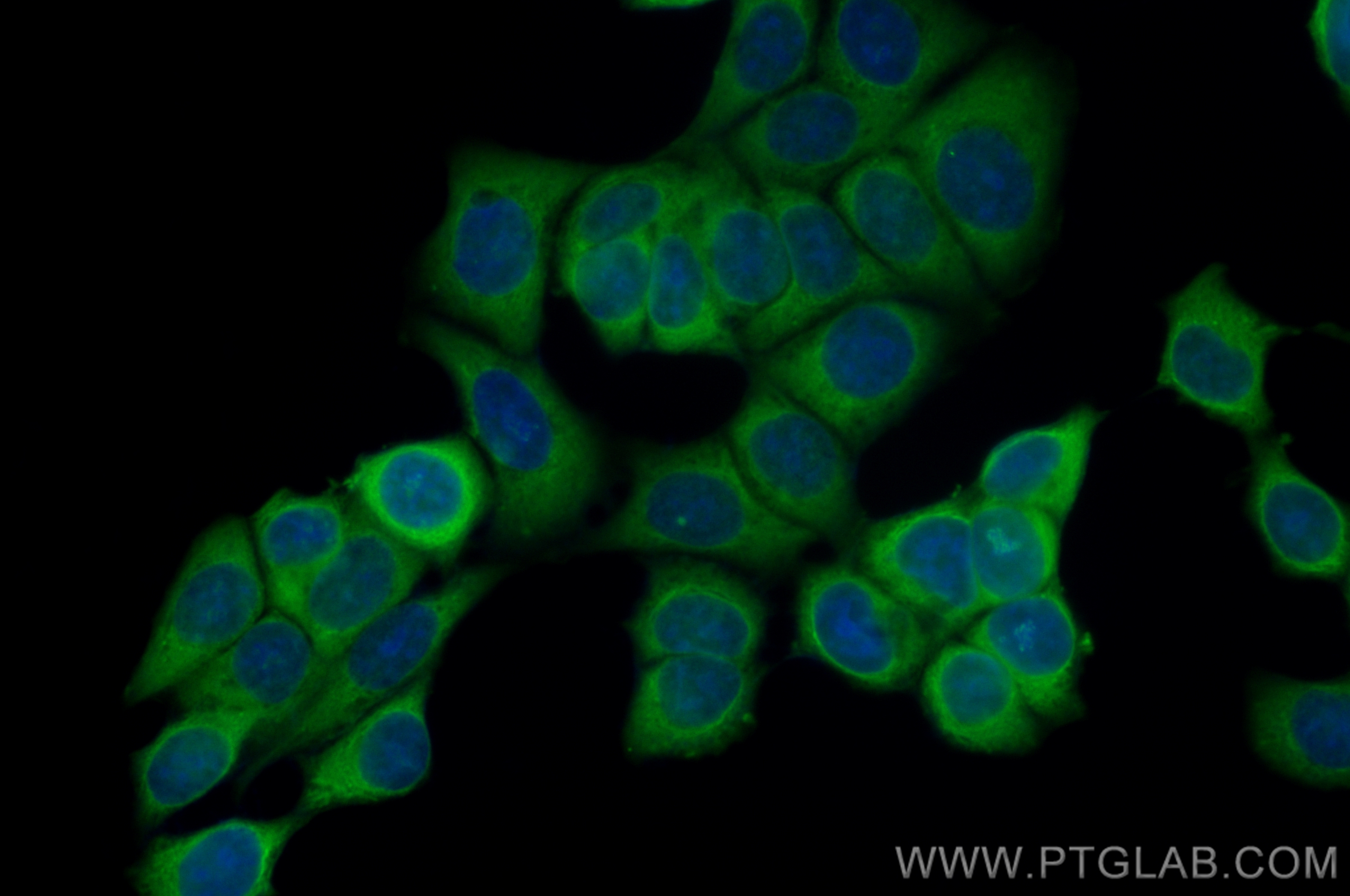 IF Staining of MCF-7 using CL488-83517-3