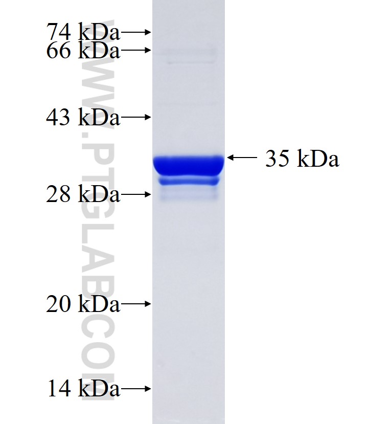 RPS11 fusion protein Ag34848 SDS-PAGE