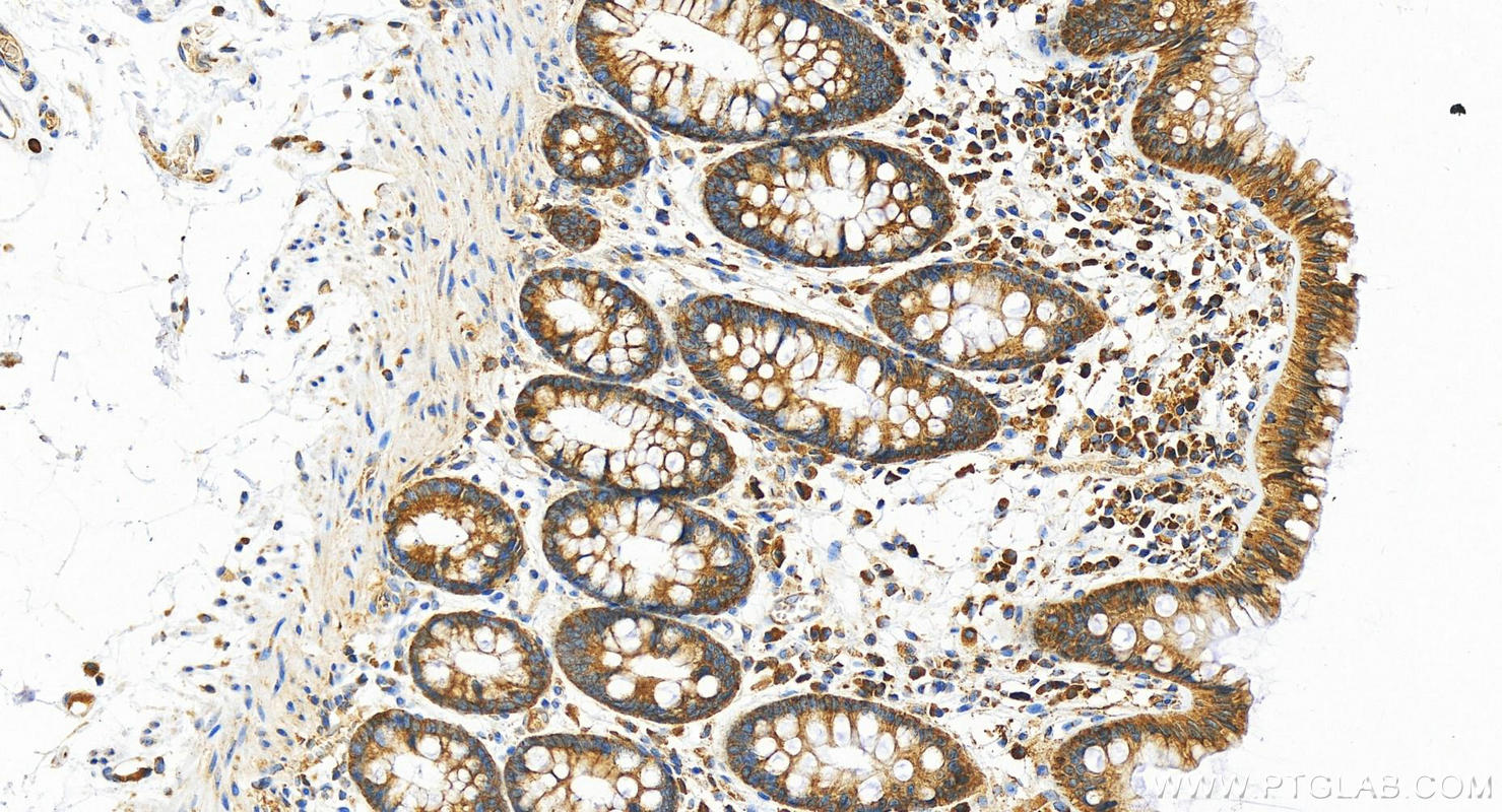 IHC staining of human  colon using 16683-1-AP