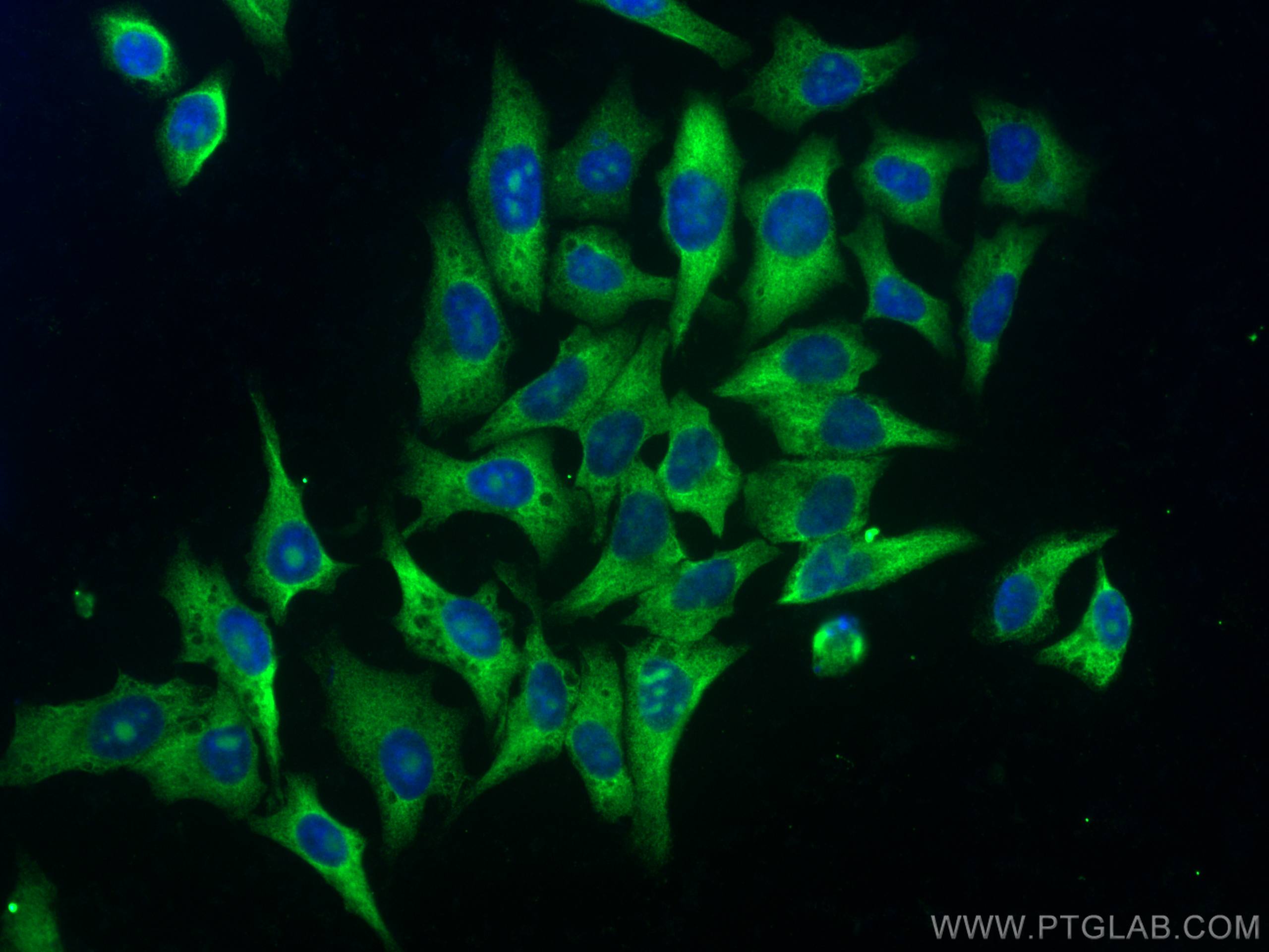 IF Staining of HepG2 using 67566-1-Ig