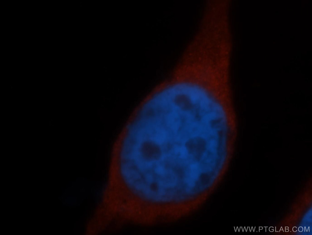 IF Staining of HeLa using 14957-1-AP