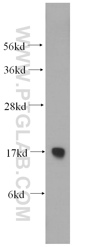 WB analysis of human liver using 14957-1-AP