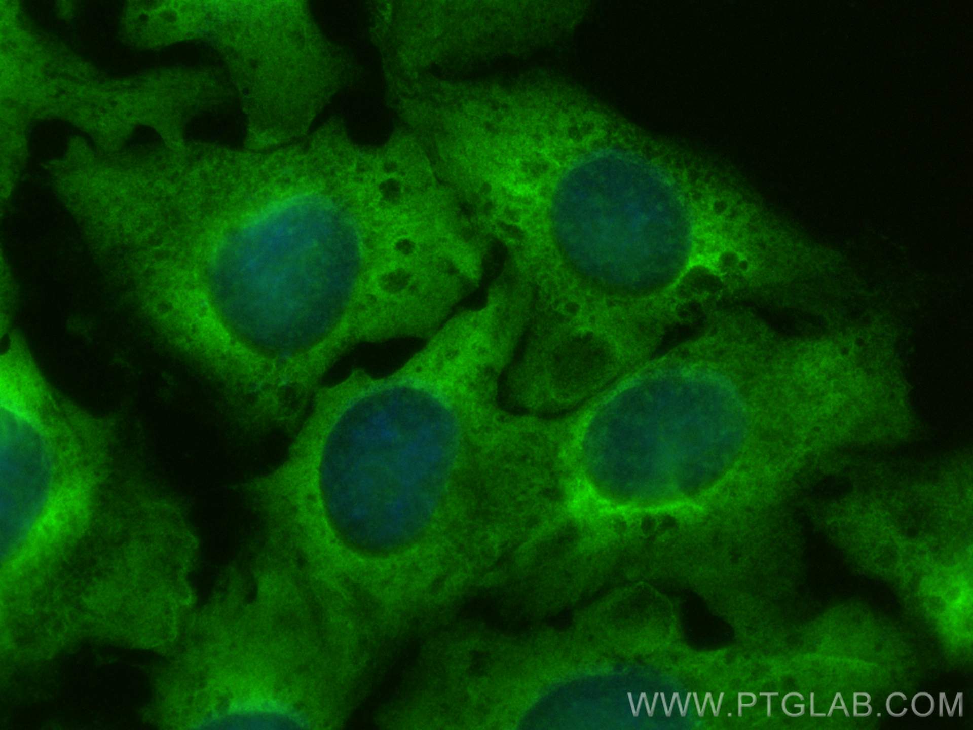 IF Staining of U2OS using 16267-1-AP